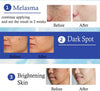Dr Yanhee Melasma Cream