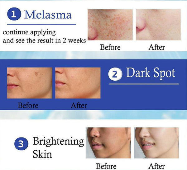 Dr Yanhee Melasma Cream
