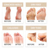 Banana Softly Peel Foot Mask